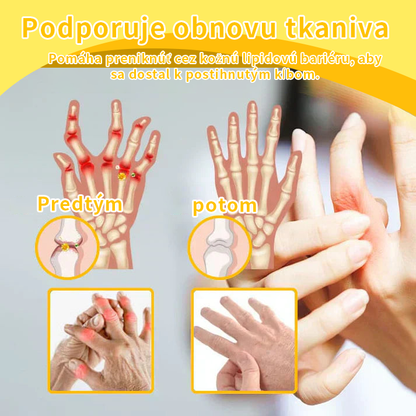 Ropceer™ hojivý krém na bolesť kostí s botulotoxínom a včelím jedom