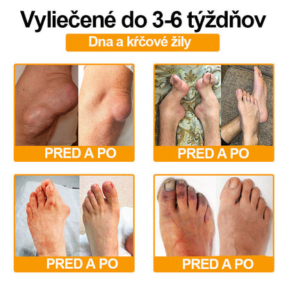 Ropceer™ hojivý krém na bolesť kostí s botulotoxínom a včelím jedom