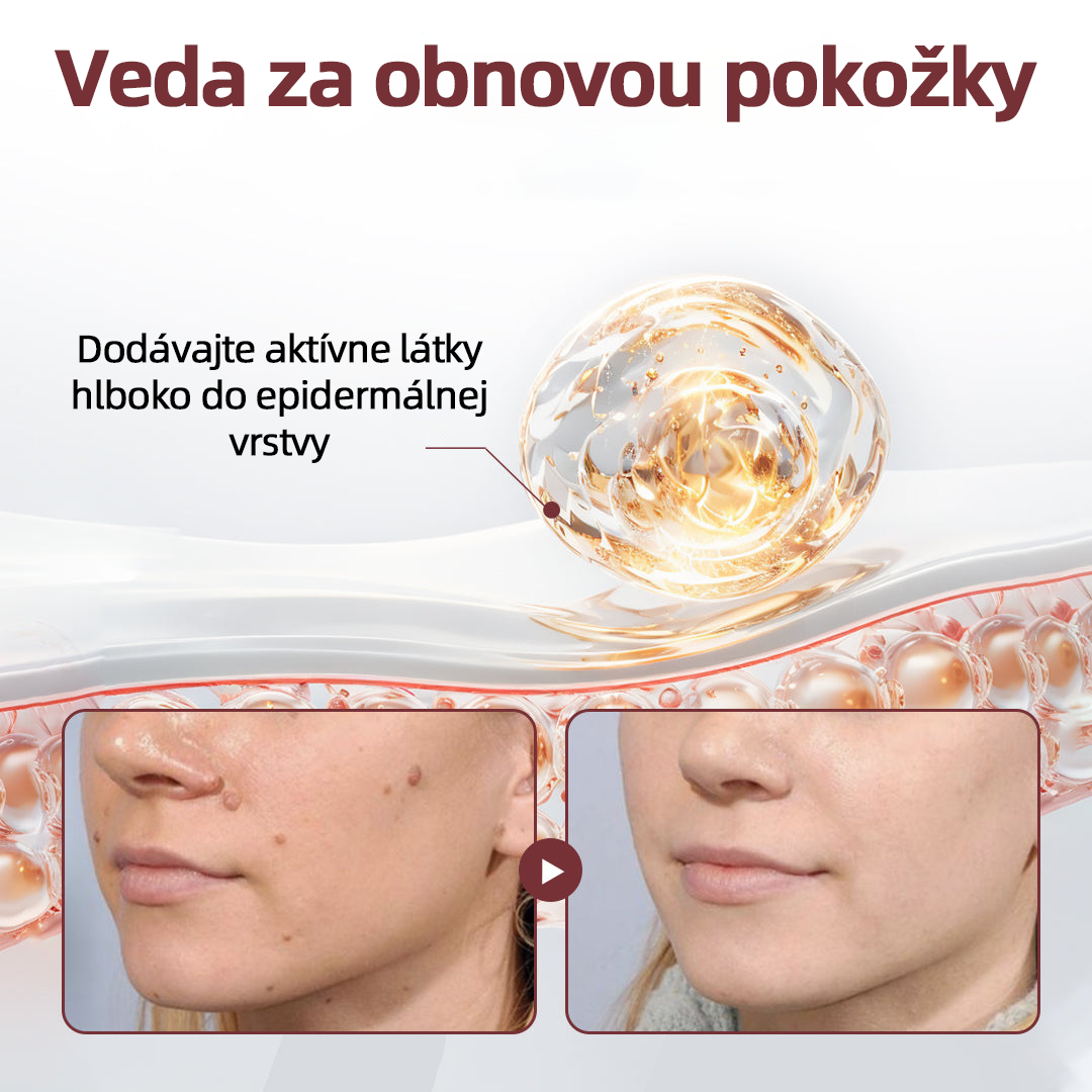 🇸🇰 Dvojčinný obnovovací krém 🧪Curevivo® KeraErase👨‍⚕️