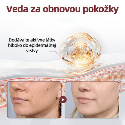 🇸🇰 Dvojčinný obnovovací krém 🧪Curevivo® KeraErase👨‍⚕️
