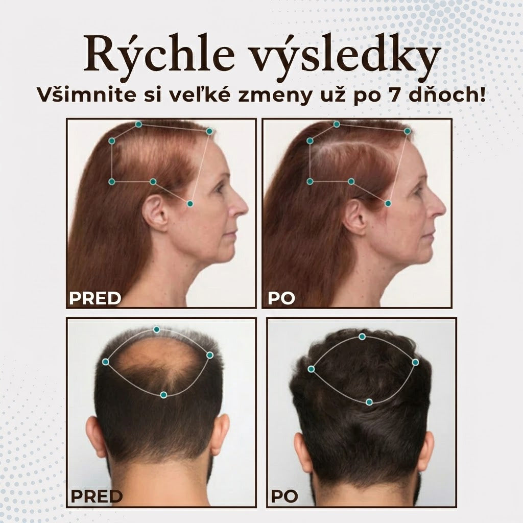 𝐍𝐚𝐣𝐩𝐫𝐞𝐝á𝐯𝐚𝐧𝐞𝐣ší 𝐩𝐫𝐨𝐝𝐮𝐤𝐭 🎉 Č𝐚𝐬𝐨𝐯𝐨 𝐨𝐛𝐦𝐞𝐝𝐳𝐞𝐧á 𝐳ľ𝐚𝐯𝐚 | 🙌𝐇𝐞𝐚𝐥𝐫𝐢𝐳𝐞® 𝐤𝐚𝐩𝐬𝐮𝐥𝐲 𝐧𝐚 𝐩𝐨𝐝𝐩𝐨𝐫𝐮 𝐫𝐚𝐬𝐭𝐮 𝐯𝐥𝐚𝐬𝐨𝐯 — 𝐩𝐨𝐦á𝐡𝐚𝐣ú 𝐩𝐨𝐝𝐩𝐨𝐫𝐢ť 𝐯𝐥𝐚𝐬𝐨𝐯é 𝐟𝐨𝐥𝐢𝐤𝐮𝐥𝐲 𝐚 𝐨𝐛𝐣𝐞𝐦𝐧𝐞𝐣ší 𝐯𝐳𝐡ľ𝐚𝐝 𝐯𝐥𝐚𝐬𝐨𝐯