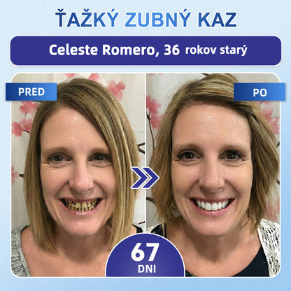 GаrаgеLіnе® 🦷 Tideglusib Rýchlo rozpustné pásiky na obnovu zubov a ďasien 💡💡(Podporujú regeneráciu zubov a pomáhajú zmierniť nepohodlie ďasien a bežné problémy ústnej dutiny)
