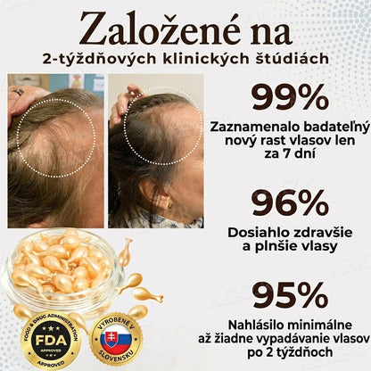 𝐍𝐚𝐣𝐩𝐫𝐞𝐝á𝐯𝐚𝐧𝐞𝐣ší 𝐩𝐫𝐨𝐝𝐮𝐤𝐭 🎉 Č𝐚𝐬𝐨𝐯𝐨 𝐨𝐛𝐦𝐞𝐝𝐳𝐞𝐧á 𝐳ľ𝐚𝐯𝐚 | 🙌𝐇𝐞𝐚𝐥𝐫𝐢𝐳𝐞® 𝐤𝐚𝐩𝐬𝐮𝐥𝐲 𝐧𝐚 𝐩𝐨𝐝𝐩𝐨𝐫𝐮 𝐫𝐚𝐬𝐭𝐮 𝐯𝐥𝐚𝐬𝐨𝐯 — 𝐩𝐨𝐦á𝐡𝐚𝐣ú 𝐩𝐨𝐝𝐩𝐨𝐫𝐢ť 𝐯𝐥𝐚𝐬𝐨𝐯é 𝐟𝐨𝐥𝐢𝐤𝐮𝐥𝐲 𝐚 𝐨𝐛𝐣𝐞𝐦𝐧𝐞𝐣ší 𝐯𝐳𝐡ľ𝐚𝐝 𝐯𝐥𝐚𝐬𝐨𝐯