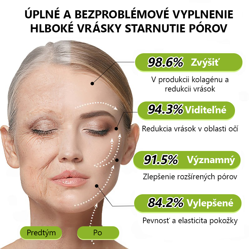 [🔥Last Day 70% OFF] Toclvo® Botox a vitamín A retinolová injekcia - Eraser for Deep Wrinkles, Sagging Jowls & Puffy Eyes