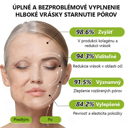 [🔥Last Day 70% OFF] Toclvo® Botox a vitamín A retinolová injekcia - Eraser for Deep Wrinkles, Sagging Jowls & Puffy Eyes