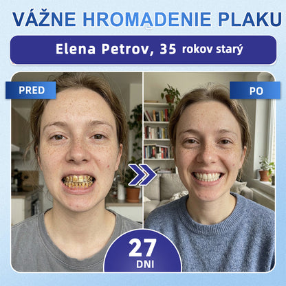 GаrаgеLіnе® 🦷 Tideglusib Rýchlo rozpustné pásiky na obnovu zubov a ďasien 💡💡(Podporujú regeneráciu zubov a pomáhajú zmierniť nepohodlie ďasien a bežné problémy ústnej dutiny)