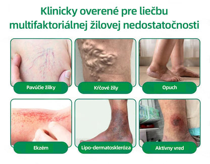 🇸🇰 Healrize® VeinTarget mikrojihlová náplasť 🏆 Okamžitá úľava, dlhodobé výsledky🪇🪇🪇