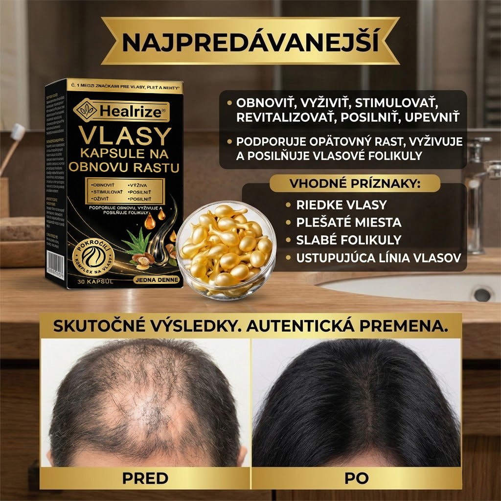 𝐍𝐚𝐣𝐩𝐫𝐞𝐝á𝐯𝐚𝐧𝐞𝐣ší 𝐩𝐫𝐨𝐝𝐮𝐤𝐭 🎉 Č𝐚𝐬𝐨𝐯𝐨 𝐨𝐛𝐦𝐞𝐝𝐳𝐞𝐧á 𝐳ľ𝐚𝐯𝐚 | 🙌𝐇𝐞𝐚𝐥𝐫𝐢𝐳𝐞® 𝐤𝐚𝐩𝐬𝐮𝐥𝐲 𝐧𝐚 𝐩𝐨𝐝𝐩𝐨𝐫𝐮 𝐫𝐚𝐬𝐭𝐮 𝐯𝐥𝐚𝐬𝐨𝐯 — 𝐩𝐨𝐦á𝐡𝐚𝐣ú 𝐩𝐨𝐝𝐩𝐨𝐫𝐢ť 𝐯𝐥𝐚𝐬𝐨𝐯é 𝐟𝐨𝐥𝐢𝐤𝐮𝐥𝐲 𝐚 𝐨𝐛𝐣𝐞𝐦𝐧𝐞𝐣ší 𝐯𝐳𝐡ľ𝐚𝐝 𝐯𝐥𝐚𝐬𝐨𝐯