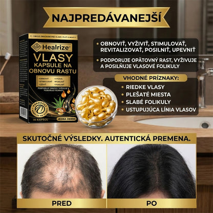 𝐍𝐚𝐣𝐩𝐫𝐞𝐝á𝐯𝐚𝐧𝐞𝐣ší 𝐩𝐫𝐨𝐝𝐮𝐤𝐭 🎉 Č𝐚𝐬𝐨𝐯𝐨 𝐨𝐛𝐦𝐞𝐝𝐳𝐞𝐧á 𝐳ľ𝐚𝐯𝐚 | 🙌𝐇𝐞𝐚𝐥𝐫𝐢𝐳𝐞® 𝐤𝐚𝐩𝐬𝐮𝐥𝐲 𝐧𝐚 𝐩𝐨𝐝𝐩𝐨𝐫𝐮 𝐫𝐚𝐬𝐭𝐮 𝐯𝐥𝐚𝐬𝐨𝐯 — 𝐩𝐨𝐦á𝐡𝐚𝐣ú 𝐩𝐨𝐝𝐩𝐨𝐫𝐢ť 𝐯𝐥𝐚𝐬𝐨𝐯é 𝐟𝐨𝐥𝐢𝐤𝐮𝐥𝐲 𝐚 𝐨𝐛𝐣𝐞𝐦𝐧𝐞𝐣ší 𝐯𝐳𝐡ľ𝐚𝐝 𝐯𝐥𝐚𝐬𝐨𝐯
