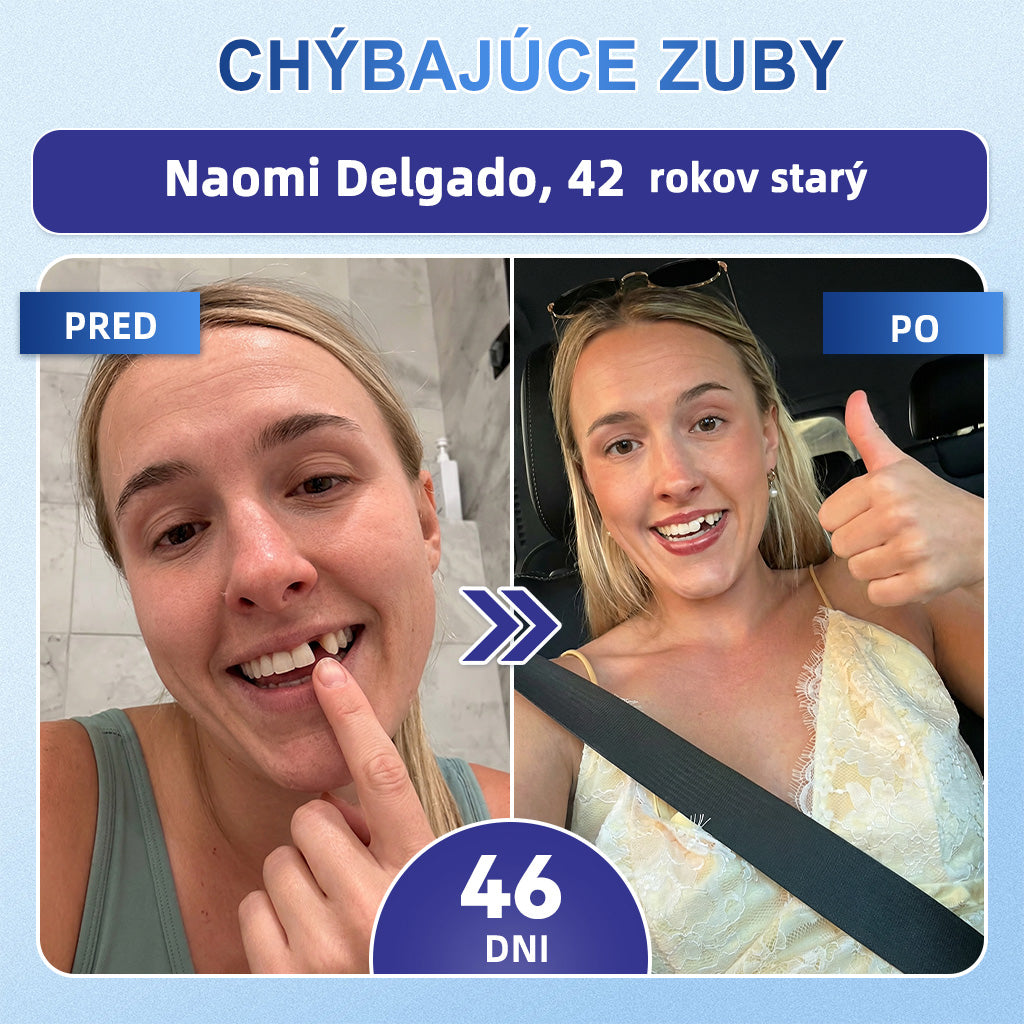 GаrаgеLіnе® 🦷 Tideglusib Rýchlo rozpustné pásiky na obnovu zubov a ďasien 💡💡(Podporujú regeneráciu zubov a pomáhajú zmierniť nepohodlie ďasien a bežné problémy ústnej dutiny)
