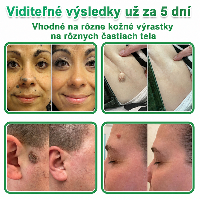 🇸🇰 𝐇𝐮𝐝𝐫𝐨𝐬® 💦💦𝟐-𝐯-𝟏 𝐡𝐲𝐝𝐫𝐨𝐤𝐨𝐥𝐨𝐢𝐝𝐧é 𝐧á𝐩𝐥𝐚𝐬𝐭𝐢 𝐬 𝐦𝐢𝐤𝐫𝐨𝐢𝐡𝐥𝐢č𝐤𝐚𝐦𝐢 | Š𝐩𝐞𝐜𝐢á𝐥𝐧𝐞 𝐯𝐲𝐯𝐢𝐧𝐮𝐭é 𝐧𝐚 𝐨𝐝𝐬𝐭𝐫𝐚ň𝐨𝐯𝐚𝐧𝐢𝐞 𝐯𝐲𝐯ýš𝐞𝐧ý𝐜𝐡 𝐦𝐚𝐭𝐞𝐫𝐬𝐤ý𝐜𝐡 𝐳𝐧𝐚𝐦𝐢𝐞𝐧𝐨𝐤, 𝐚𝐤𝐧é, 𝐩𝐥𝐨𝐜𝐡ý𝐜𝐡 𝐛𝐫𝐚𝐝𝐚𝐯í𝐜 𝐚 𝐤𝐨ž𝐧ý𝐜𝐡 𝐯ý𝐫𝐚𝐬𝐭𝐤𝐨𝐯 | 𝐁𝐚𝐥𝐞𝐧𝐢𝐞 𝟏𝟒𝟒 𝐤𝐮𝐬𝐨𝐯🔬🔬