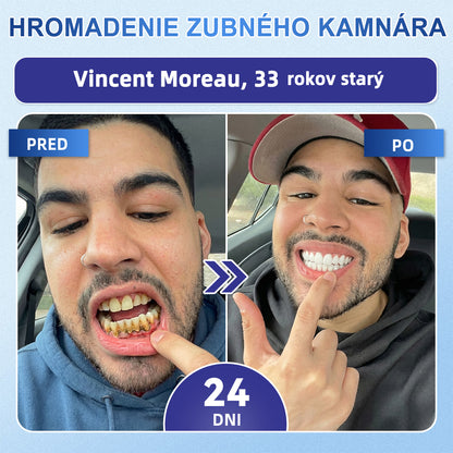GаrаgеLіnе® 🦷 Tideglusib Rýchlo rozpustné pásiky na obnovu zubov a ďasien 💡💡(Podporujú regeneráciu zubov a pomáhajú zmierniť nepohodlie ďasien a bežné problémy ústnej dutiny)