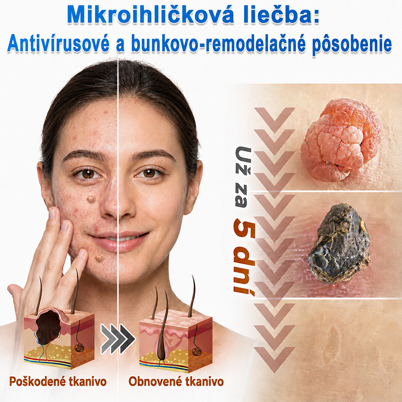 🇸🇰 𝐇𝐮𝐝𝐫𝐨𝐬® 💦💦𝟐-𝐯-𝟏 𝐡𝐲𝐝𝐫𝐨𝐤𝐨𝐥𝐨𝐢𝐝𝐧é 𝐧á𝐩𝐥𝐚𝐬𝐭𝐢 𝐬 𝐦𝐢𝐤𝐫𝐨𝐢𝐡𝐥𝐢č𝐤𝐚𝐦𝐢 | Š𝐩𝐞𝐜𝐢á𝐥𝐧𝐞 𝐯𝐲𝐯𝐢𝐧𝐮𝐭é 𝐧𝐚 𝐨𝐝𝐬𝐭𝐫𝐚ň𝐨𝐯𝐚𝐧𝐢𝐞 𝐯𝐲𝐯ýš𝐞𝐧ý𝐜𝐡 𝐦𝐚𝐭𝐞𝐫𝐬𝐤ý𝐜𝐡 𝐳𝐧𝐚𝐦𝐢𝐞𝐧𝐨𝐤, 𝐚𝐤𝐧é, 𝐩𝐥𝐨𝐜𝐡ý𝐜𝐡 𝐛𝐫𝐚𝐝𝐚𝐯í𝐜 𝐚 𝐤𝐨ž𝐧ý𝐜𝐡 𝐯ý𝐫𝐚𝐬𝐭𝐤𝐨𝐯 | 𝐁𝐚𝐥𝐞𝐧𝐢𝐞 𝟏𝟒𝟒 𝐤𝐮𝐬𝐨𝐯🔬🔬