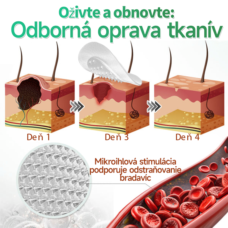 🇸🇰 𝐇𝐮𝐝𝐫𝐨𝐬® 💦💦𝟐-𝐯-𝟏 𝐡𝐲𝐝𝐫𝐨𝐤𝐨𝐥𝐨𝐢𝐝𝐧é 𝐧á𝐩𝐥𝐚𝐬𝐭𝐢 𝐬 𝐦𝐢𝐤𝐫𝐨𝐢𝐡𝐥𝐢č𝐤𝐚𝐦𝐢 | Š𝐩𝐞𝐜𝐢á𝐥𝐧𝐞 𝐯𝐲𝐯𝐢𝐧𝐮𝐭é 𝐧𝐚 𝐨𝐝𝐬𝐭𝐫𝐚ň𝐨𝐯𝐚𝐧𝐢𝐞 𝐯𝐲𝐯ýš𝐞𝐧ý𝐜𝐡 𝐦𝐚𝐭𝐞𝐫𝐬𝐤ý𝐜𝐡 𝐳𝐧𝐚𝐦𝐢𝐞𝐧𝐨𝐤, 𝐚𝐤𝐧é, 𝐩𝐥𝐨𝐜𝐡ý𝐜𝐡 𝐛𝐫𝐚𝐝𝐚𝐯í𝐜 𝐚 𝐤𝐨ž𝐧ý𝐜𝐡 𝐯ý𝐫𝐚𝐬𝐭𝐤𝐨𝐯 | 𝐁𝐚𝐥𝐞𝐧𝐢𝐞 𝟏𝟒𝟒 𝐤𝐮𝐬𝐨𝐯🔬🔬