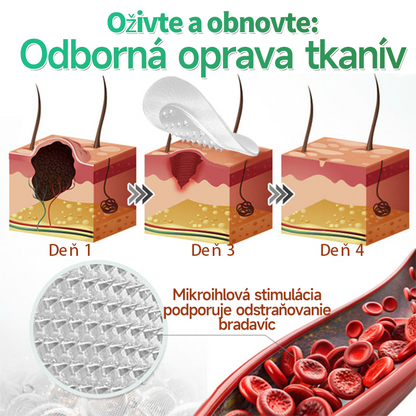 🇸🇰 𝐇𝐮𝐝𝐫𝐨𝐬® 💦💦𝟐-𝐯-𝟏 𝐡𝐲𝐝𝐫𝐨𝐤𝐨𝐥𝐨𝐢𝐝𝐧é 𝐧á𝐩𝐥𝐚𝐬𝐭𝐢 𝐬 𝐦𝐢𝐤𝐫𝐨𝐢𝐡𝐥𝐢č𝐤𝐚𝐦𝐢 | Š𝐩𝐞𝐜𝐢á𝐥𝐧𝐞 𝐯𝐲𝐯𝐢𝐧𝐮𝐭é 𝐧𝐚 𝐨𝐝𝐬𝐭𝐫𝐚ň𝐨𝐯𝐚𝐧𝐢𝐞 𝐯𝐲𝐯ýš𝐞𝐧ý𝐜𝐡 𝐦𝐚𝐭𝐞𝐫𝐬𝐤ý𝐜𝐡 𝐳𝐧𝐚𝐦𝐢𝐞𝐧𝐨𝐤, 𝐚𝐤𝐧é, 𝐩𝐥𝐨𝐜𝐡ý𝐜𝐡 𝐛𝐫𝐚𝐝𝐚𝐯í𝐜 𝐚 𝐤𝐨ž𝐧ý𝐜𝐡 𝐯ý𝐫𝐚𝐬𝐭𝐤𝐨𝐯 | 𝐁𝐚𝐥𝐞𝐧𝐢𝐞 𝟏𝟒𝟒 𝐤𝐮𝐬𝐨𝐯🔬🔬
