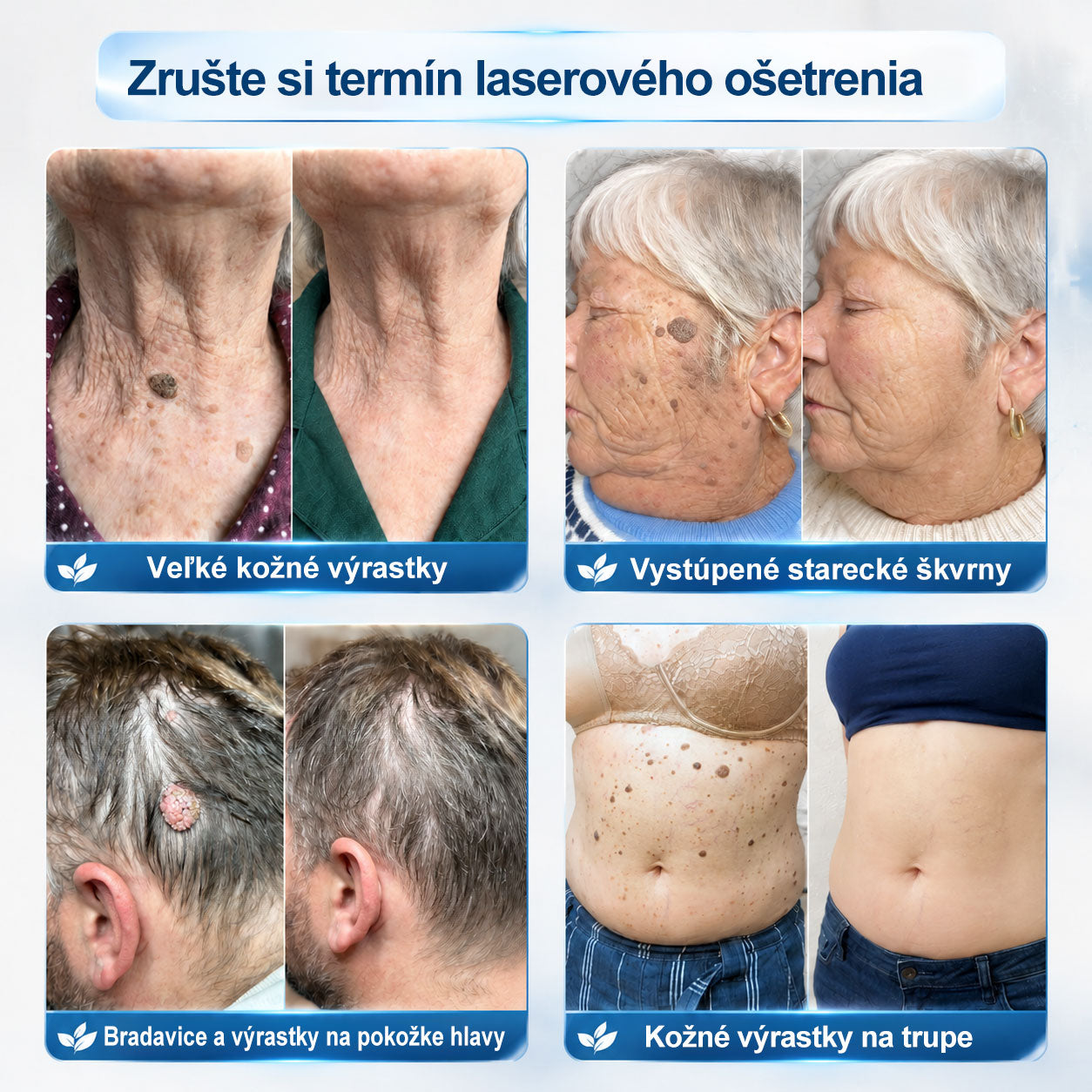 𝐎𝐟𝐢𝐜𝐢𝐚𝐥𝐧𝐲 𝐨𝐛𝐜𝐡𝐨𝐝 𝐦𝐚𝐫𝐤𝐲 | ✅️ 𝐓𝐫𝐢𝐥𝐮𝐦𝐢𝐚® 𝟕𝐝𝐧𝐢 𝐏𝐫í𝐩𝐫𝐚𝐯𝐨𝐤 𝐧𝐚 𝐨𝐝𝐬𝐭𝐫á𝐧𝐞𝐧𝐢𝐞 𝐤𝐨ž𝐧ý𝐜𝐡 𝐯ý𝐫𝐚𝐬𝐭𝐤𝐨𝐯 𝐚 𝐩𝐢𝐠𝐦𝐞𝐧𝐭𝐨𝐯ý𝐜𝐡 š𝐤𝐯ŕ𝐧 (𝐛𝐞𝐳𝐛𝐨𝐥𝐞𝐬𝐭𝐧ý 𝐫𝐨𝐥𝐥-𝐨𝐧 𝐚𝐩𝐥𝐢𝐤á𝐭𝐨𝐫 𝐛𝐞𝐳 𝐣𝐚𝐳𝐢𝐞𝐯) 😍