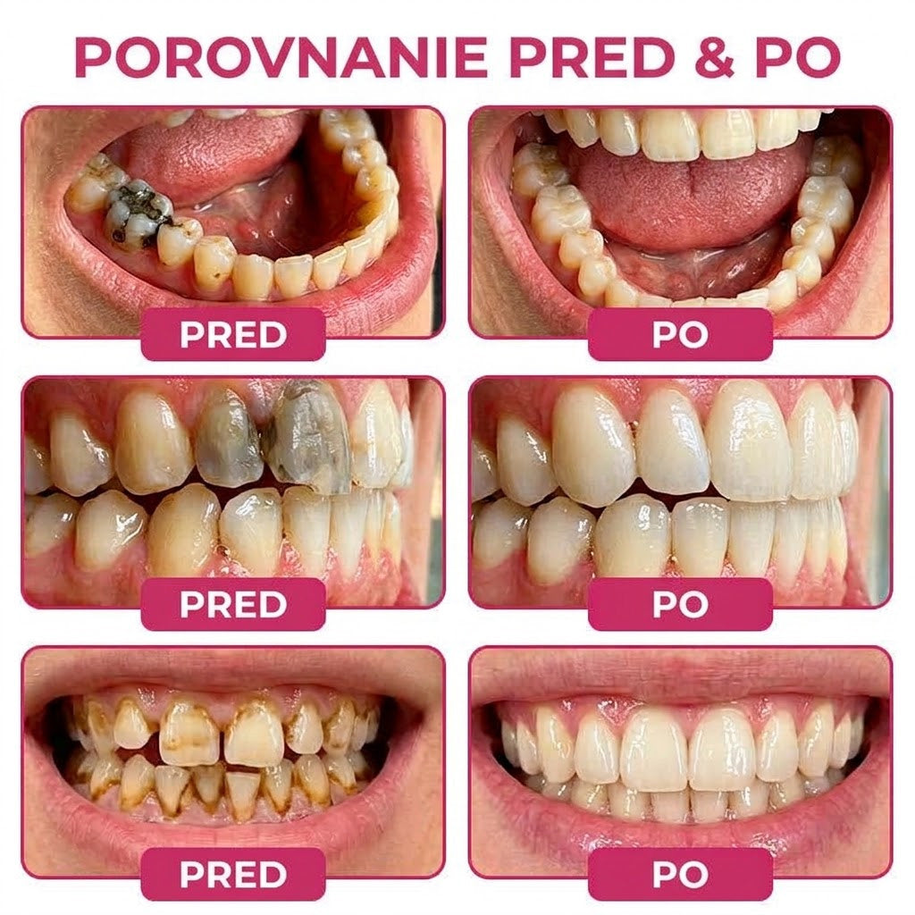 🛡️ 𝐓𝐫𝐢𝐥𝐮𝐦𝐢𝐚® 🦷 𝐃𝐞𝐧𝐏𝐞𝐫𝐦 – 𝐆é𝐥 𝐧𝐚 𝐨𝐛𝐧𝐨𝐯𝐮 𝐳𝐮𝐛𝐧é𝐡𝐨 𝐤𝐚𝐳𝐮 𝐚 𝐩𝐫𝐢𝐫𝐨𝐝𝐳𝐞𝐧ú 𝐫𝐞𝐦𝐢𝐧𝐞𝐫𝐚𝐥𝐢𝐳á𝐜𝐢𝐮 𝐳𝐮𝐛𝐧𝐞𝐣 𝐬𝐤𝐥𝐨𝐯𝐢𝐧𝐲🍠