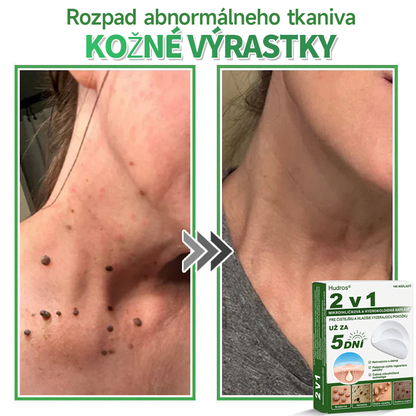 🇸🇰 𝐇𝐮𝐝𝐫𝐨𝐬® 💦💦𝟐-𝐯-𝟏 𝐡𝐲𝐝𝐫𝐨𝐤𝐨𝐥𝐨𝐢𝐝𝐧é 𝐧á𝐩𝐥𝐚𝐬𝐭𝐢 𝐬 𝐦𝐢𝐤𝐫𝐨𝐢𝐡𝐥𝐢č𝐤𝐚𝐦𝐢 | Š𝐩𝐞𝐜𝐢á𝐥𝐧𝐞 𝐯𝐲𝐯𝐢𝐧𝐮𝐭é 𝐧𝐚 𝐨𝐝𝐬𝐭𝐫𝐚ň𝐨𝐯𝐚𝐧𝐢𝐞 𝐯𝐲𝐯ýš𝐞𝐧ý𝐜𝐡 𝐦𝐚𝐭𝐞𝐫𝐬𝐤ý𝐜𝐡 𝐳𝐧𝐚𝐦𝐢𝐞𝐧𝐨𝐤, 𝐚𝐤𝐧é, 𝐩𝐥𝐨𝐜𝐡ý𝐜𝐡 𝐛𝐫𝐚𝐝𝐚𝐯í𝐜 𝐚 𝐤𝐨ž𝐧ý𝐜𝐡 𝐯ý𝐫𝐚𝐬𝐭𝐤𝐨𝐯 | 𝐁𝐚𝐥𝐞𝐧𝐢𝐞 𝟏𝟒𝟒 𝐤𝐮𝐬𝐨𝐯🔬🔬