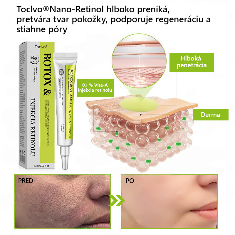 [🔥Last Day 70% OFF] Toclvo® Botox a vitamín A retinolová injekcia - Eraser for Deep Wrinkles, Sagging Jowls & Puffy Eyes