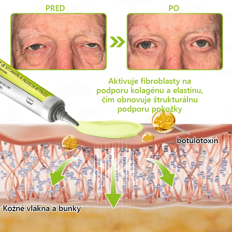 [🔥Last Day 70% OFF] Toclvo® Botox a vitamín A retinolová injekcia - Eraser for Deep Wrinkles, Sagging Jowls & Puffy Eyes