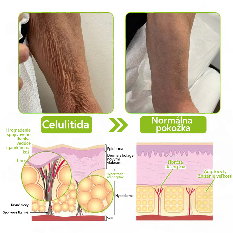 [🔥Last Day 70% OFF] Toclvo® Botox a vitamín A retinolová injekcia - Eraser for Deep Wrinkles, Sagging Jowls & Puffy Eyes