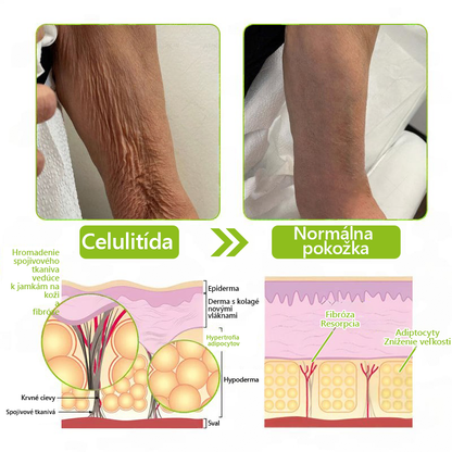 [🔥Last Day 70% OFF] Toclvo® Botox a vitamín A retinolová injekcia - Eraser for Deep Wrinkles, Sagging Jowls & Puffy Eyes