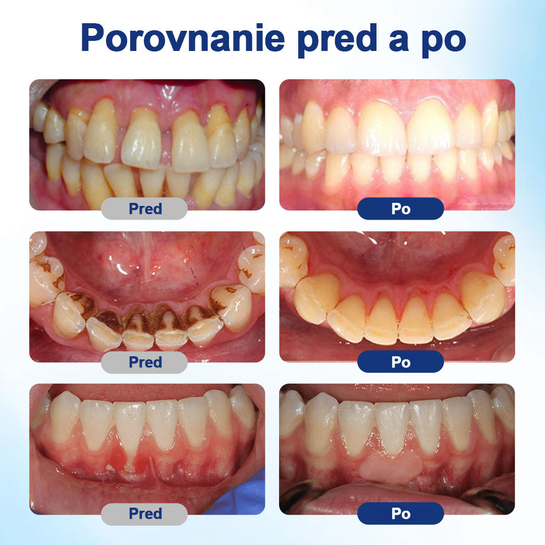𝑯𝑬𝑨𝑻𝑾𝑶𝑳𝑭® 👨‍⚕️𝑩𝒆𝒆𝑻𝒂𝒌𝒕 𝑹𝒐𝒛𝒕𝒐𝒌 𝒏𝒂 𝒐𝒃𝒏𝒐𝒗𝒖 ú𝒔𝒕𝒏𝒆𝒋 𝒅𝒖𝒕𝒊𝒏𝒚 🥬🥬