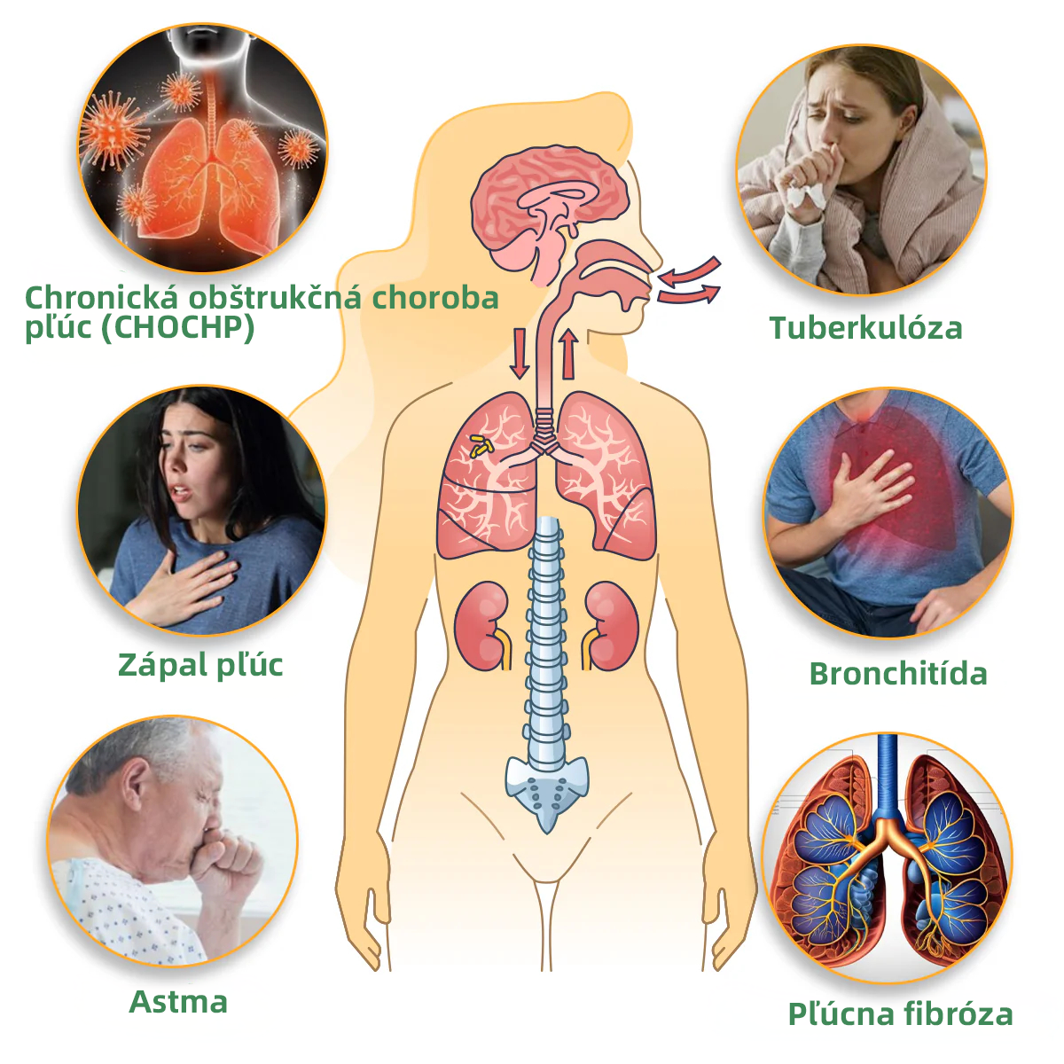 💝✅Oficiálny obchod::Thonesr® Bylinný Inhalátor Na Čistenie Pľúc🫁Schválené ŠÚKL(💝 Cough, wheezing, shortness of breath, sputum, stuffy nose, bronchitis, bronchitis, allergy symptoms, lung discomfort💝)