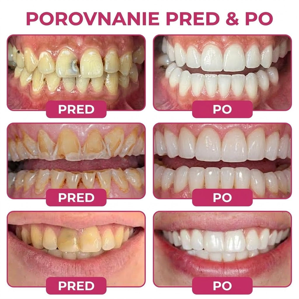 🛡️ 𝐓𝐫𝐢𝐥𝐮𝐦𝐢𝐚® 🦷 𝐃𝐞𝐧𝐏𝐞𝐫𝐦 – 𝐆é𝐥 𝐧𝐚 𝐨𝐛𝐧𝐨𝐯𝐮 𝐳𝐮𝐛𝐧é𝐡𝐨 𝐤𝐚𝐳𝐮 𝐚 𝐩𝐫𝐢𝐫𝐨𝐝𝐳𝐞𝐧ú 𝐫𝐞𝐦𝐢𝐧𝐞𝐫𝐚𝐥𝐢𝐳á𝐜𝐢𝐮 𝐳𝐮𝐛𝐧𝐞𝐣 𝐬𝐤𝐥𝐨𝐯𝐢𝐧𝐲🍠