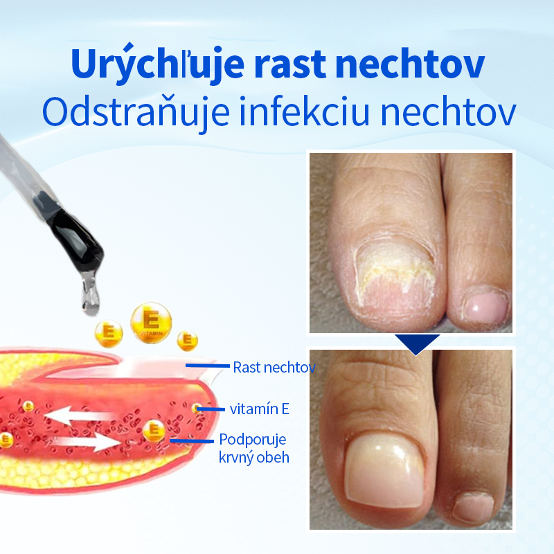 Ropceer™ OnyxoGuard Klinec rast a Opravné sérum