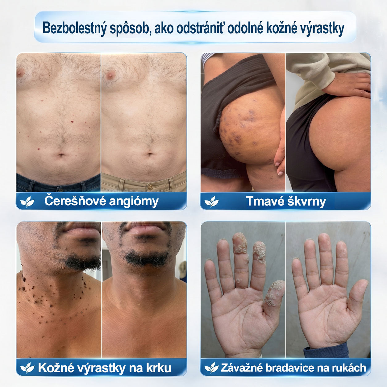 𝐎𝐟𝐢𝐜𝐢𝐚𝐥𝐧𝐲 𝐨𝐛𝐜𝐡𝐨𝐝 𝐦𝐚𝐫𝐤𝐲 | ✅️ 𝐓𝐫𝐢𝐥𝐮𝐦𝐢𝐚® 𝟕𝐝𝐧𝐢 𝐏𝐫í𝐩𝐫𝐚𝐯𝐨𝐤 𝐧𝐚 𝐨𝐝𝐬𝐭𝐫á𝐧𝐞𝐧𝐢𝐞 𝐤𝐨ž𝐧ý𝐜𝐡 𝐯ý𝐫𝐚𝐬𝐭𝐤𝐨𝐯 𝐚 𝐩𝐢𝐠𝐦𝐞𝐧𝐭𝐨𝐯ý𝐜𝐡 š𝐤𝐯ŕ𝐧 (𝐛𝐞𝐳𝐛𝐨𝐥𝐞𝐬𝐭𝐧ý 𝐫𝐨𝐥𝐥-𝐨𝐧 𝐚𝐩𝐥𝐢𝐤á𝐭𝐨𝐫 𝐛𝐞𝐳 𝐣𝐚𝐳𝐢𝐞𝐯) 😍
