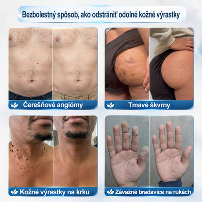 𝐎𝐟𝐢𝐜𝐢𝐚𝐥𝐧𝐲 𝐨𝐛𝐜𝐡𝐨𝐝 𝐦𝐚𝐫𝐤𝐲 | ✅️ 𝐓𝐫𝐢𝐥𝐮𝐦𝐢𝐚® 𝟕𝐝𝐧𝐢 𝐏𝐫í𝐩𝐫𝐚𝐯𝐨𝐤 𝐧𝐚 𝐨𝐝𝐬𝐭𝐫á𝐧𝐞𝐧𝐢𝐞 𝐤𝐨ž𝐧ý𝐜𝐡 𝐯ý𝐫𝐚𝐬𝐭𝐤𝐨𝐯 𝐚 𝐩𝐢𝐠𝐦𝐞𝐧𝐭𝐨𝐯ý𝐜𝐡 š𝐤𝐯ŕ𝐧 (𝐛𝐞𝐳𝐛𝐨𝐥𝐞𝐬𝐭𝐧ý 𝐫𝐨𝐥𝐥-𝐨𝐧 𝐚𝐩𝐥𝐢𝐤á𝐭𝐨𝐫 𝐛𝐞𝐳 𝐣𝐚𝐳𝐢𝐞𝐯) 😍