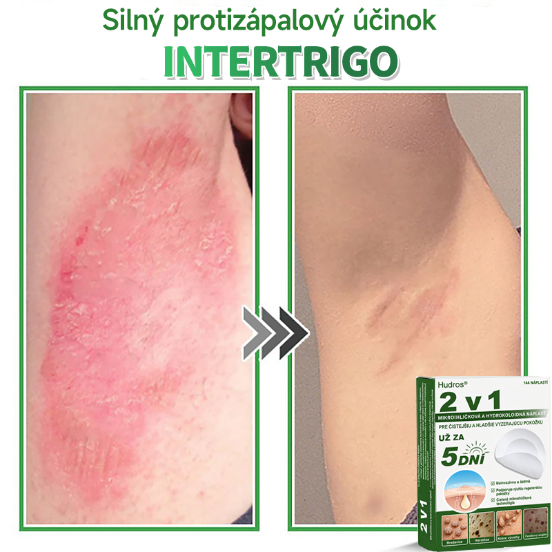 🇸🇰 𝐇𝐮𝐝𝐫𝐨𝐬® 💦💦𝟐-𝐯-𝟏 𝐡𝐲𝐝𝐫𝐨𝐤𝐨𝐥𝐨𝐢𝐝𝐧é 𝐧á𝐩𝐥𝐚𝐬𝐭𝐢 𝐬 𝐦𝐢𝐤𝐫𝐨𝐢𝐡𝐥𝐢č𝐤𝐚𝐦𝐢 | Š𝐩𝐞𝐜𝐢á𝐥𝐧𝐞 𝐯𝐲𝐯𝐢𝐧𝐮𝐭é 𝐧𝐚 𝐨𝐝𝐬𝐭𝐫𝐚ň𝐨𝐯𝐚𝐧𝐢𝐞 𝐯𝐲𝐯ýš𝐞𝐧ý𝐜𝐡 𝐦𝐚𝐭𝐞𝐫𝐬𝐤ý𝐜𝐡 𝐳𝐧𝐚𝐦𝐢𝐞𝐧𝐨𝐤, 𝐚𝐤𝐧é, 𝐩𝐥𝐨𝐜𝐡ý𝐜𝐡 𝐛𝐫𝐚𝐝𝐚𝐯í𝐜 𝐚 𝐤𝐨ž𝐧ý𝐜𝐡 𝐯ý𝐫𝐚𝐬𝐭𝐤𝐨𝐯 | 𝐁𝐚𝐥𝐞𝐧𝐢𝐞 𝟏𝟒𝟒 𝐤𝐮𝐬𝐨𝐯🔬🔬