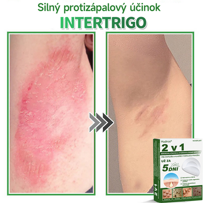 🇸🇰 𝐇𝐮𝐝𝐫𝐨𝐬® 💦💦𝟐-𝐯-𝟏 𝐡𝐲𝐝𝐫𝐨𝐤𝐨𝐥𝐨𝐢𝐝𝐧é 𝐧á𝐩𝐥𝐚𝐬𝐭𝐢 𝐬 𝐦𝐢𝐤𝐫𝐨𝐢𝐡𝐥𝐢č𝐤𝐚𝐦𝐢 | Š𝐩𝐞𝐜𝐢á𝐥𝐧𝐞 𝐯𝐲𝐯𝐢𝐧𝐮𝐭é 𝐧𝐚 𝐨𝐝𝐬𝐭𝐫𝐚ň𝐨𝐯𝐚𝐧𝐢𝐞 𝐯𝐲𝐯ýš𝐞𝐧ý𝐜𝐡 𝐦𝐚𝐭𝐞𝐫𝐬𝐤ý𝐜𝐡 𝐳𝐧𝐚𝐦𝐢𝐞𝐧𝐨𝐤, 𝐚𝐤𝐧é, 𝐩𝐥𝐨𝐜𝐡ý𝐜𝐡 𝐛𝐫𝐚𝐝𝐚𝐯í𝐜 𝐚 𝐤𝐨ž𝐧ý𝐜𝐡 𝐯ý𝐫𝐚𝐬𝐭𝐤𝐨𝐯 | 𝐁𝐚𝐥𝐞𝐧𝐢𝐞 𝟏𝟒𝟒 𝐤𝐮𝐬𝐨𝐯🔬🔬