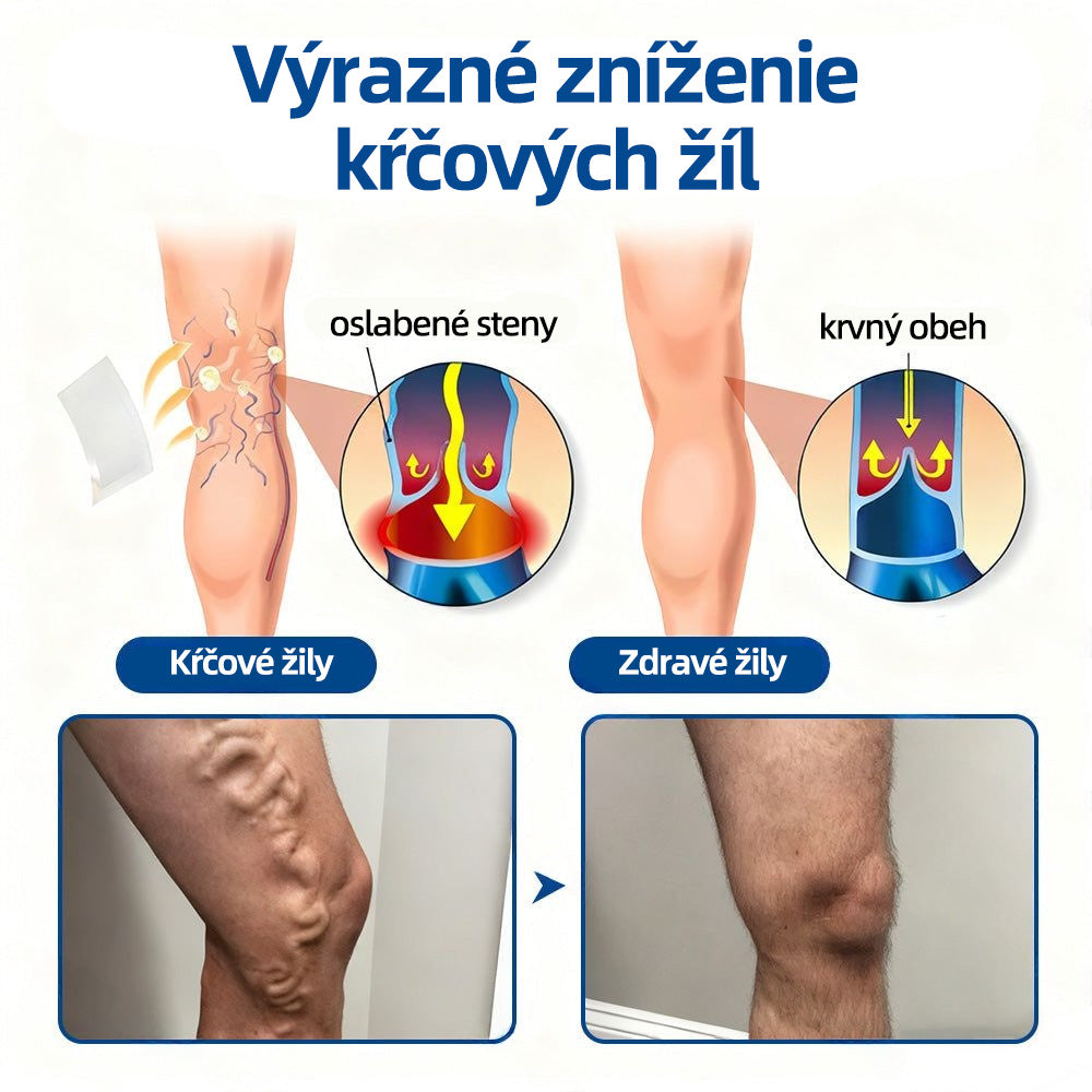 🇸🇰 Healrize® VeinTarget mikrojihlová náplasť 🏆 Okamžitá úľava, dlhodobé výsledky🎀🎀🎀
