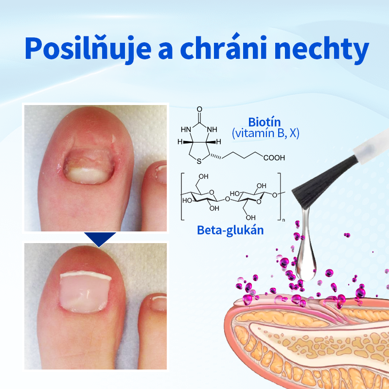 Ropceer™ OnyxoGuard Klinec rast a Opravné sérum