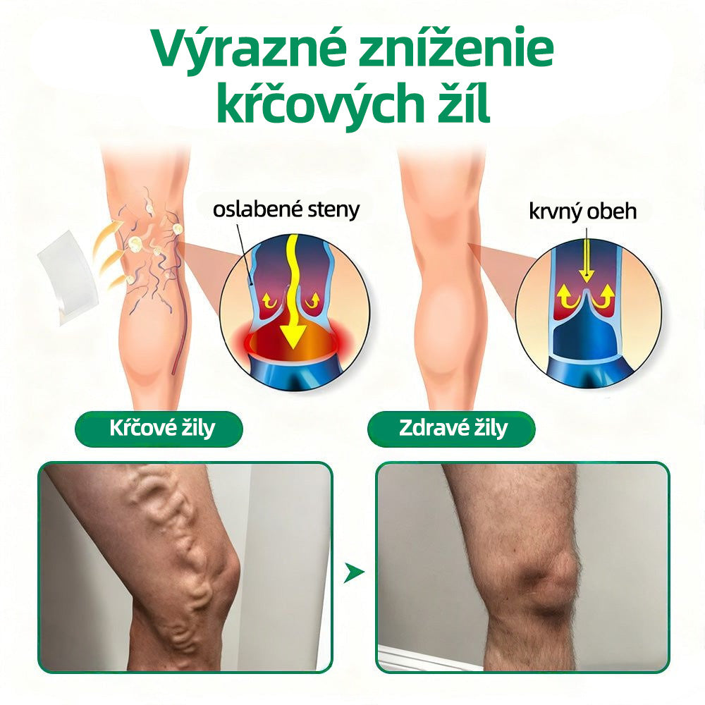 🇸🇰 Healrize® VeinTarget mikrojihlová náplasť 🏆 Okamžitá úľava, dlhodobé výsledky🪇🪇🪇