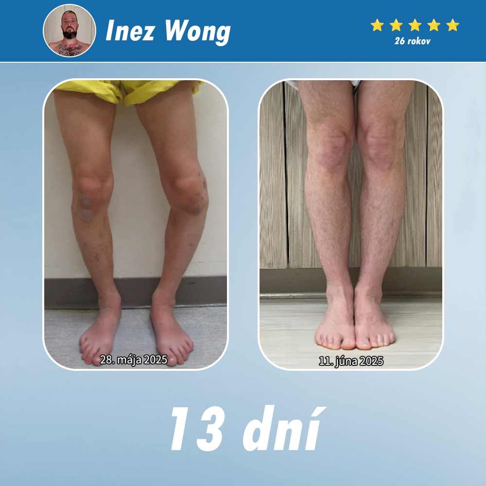 [Novoročná špeciálna ponuka] CureVivo® krém na zmiernenie bolesti a regeneráciu🌱Na bolesti svalov, kĺbov a nervov