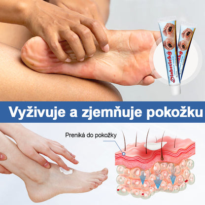 Trilumia® VitaGluco Krém na liečbu cukrovky -🌱Schválené Americkou akadémiou dermatológie (AAD) 🌱