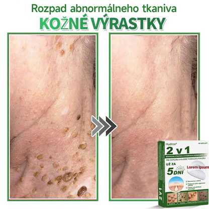 🇸🇰 𝐇𝐮𝐝𝐫𝐨𝐬® 💦💦𝟐-𝐯-𝟏 𝐡𝐲𝐝𝐫𝐨𝐤𝐨𝐥𝐨𝐢𝐝𝐧é 𝐧á𝐩𝐥𝐚𝐬𝐭𝐢 𝐬 𝐦𝐢𝐤𝐫𝐨𝐢𝐡𝐥𝐢č𝐤𝐚𝐦𝐢 | Š𝐩𝐞𝐜𝐢á𝐥𝐧𝐞 𝐯𝐲𝐯𝐢𝐧𝐮𝐭é 𝐧𝐚 𝐨𝐝𝐬𝐭𝐫𝐚ň𝐨𝐯𝐚𝐧𝐢𝐞 𝐯𝐲𝐯ýš𝐞𝐧ý𝐜𝐡 𝐦𝐚𝐭𝐞𝐫𝐬𝐤ý𝐜𝐡 𝐳𝐧𝐚𝐦𝐢𝐞𝐧𝐨𝐤, 𝐚𝐤𝐧é, 𝐩𝐥𝐨𝐜𝐡ý𝐜𝐡 𝐛𝐫𝐚𝐝𝐚𝐯í𝐜 𝐚 𝐤𝐨ž𝐧ý𝐜𝐡 𝐯ý𝐫𝐚𝐬𝐭𝐤𝐨𝐯 | 𝐁𝐚𝐥𝐞𝐧𝐢𝐞 𝟏𝟒𝟒 𝐤𝐮𝐬𝐨𝐯🔬🔬