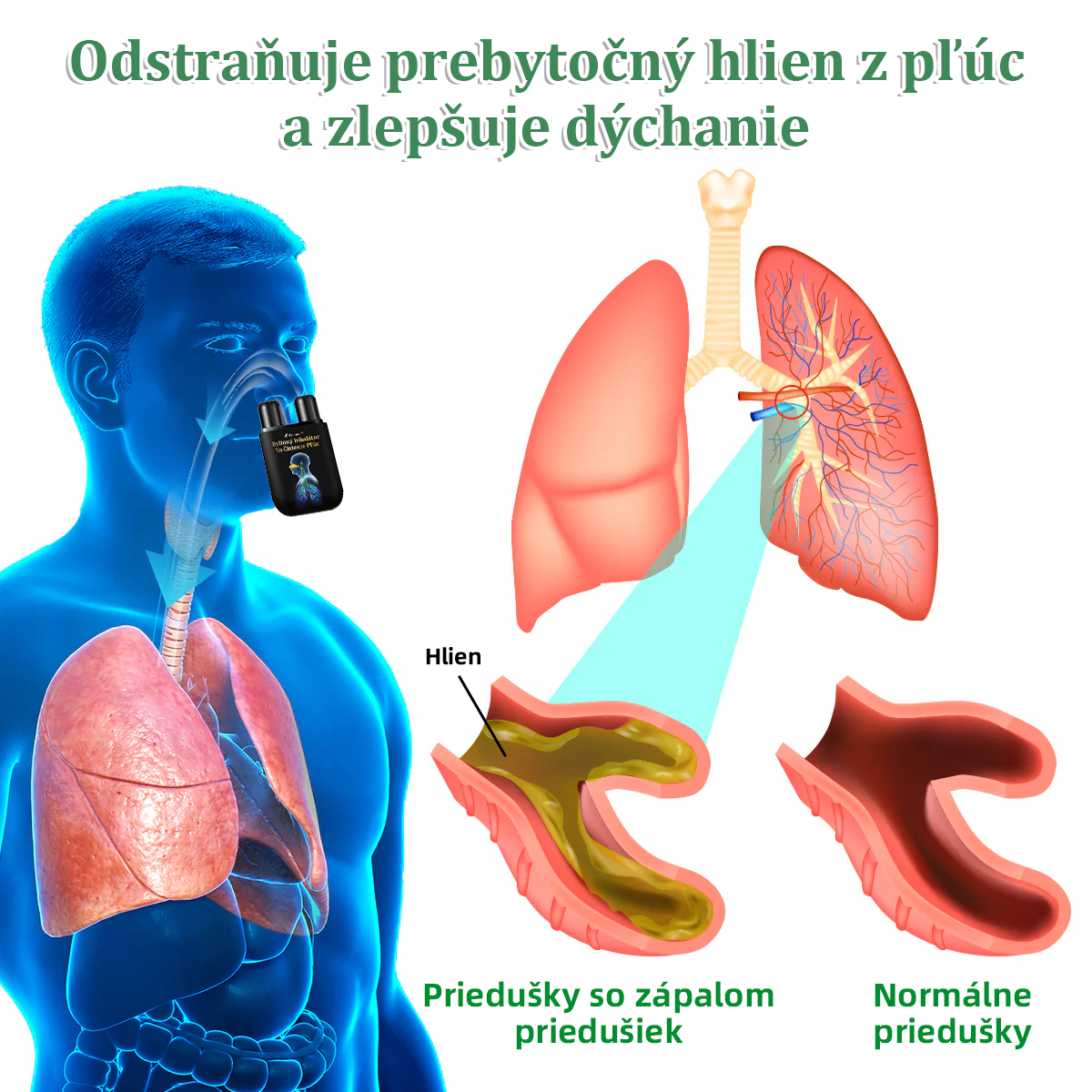 💝✅Oficiálny obchod::Thonesr® Bylinný Inhalátor Na Čistenie Pľúc🫁Schválené ŠÚKL(💝 Cough, wheezing, shortness of breath, sputum, stuffy nose, bronchitis, bronchitis, allergy symptoms, lung discomfort💝)