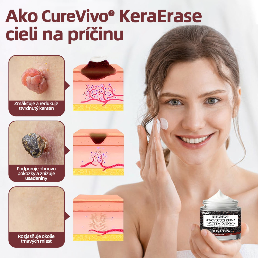 🇸🇰 Dvojčinný obnovovací krém 🧪Curevivo® KeraErase👨‍⚕️