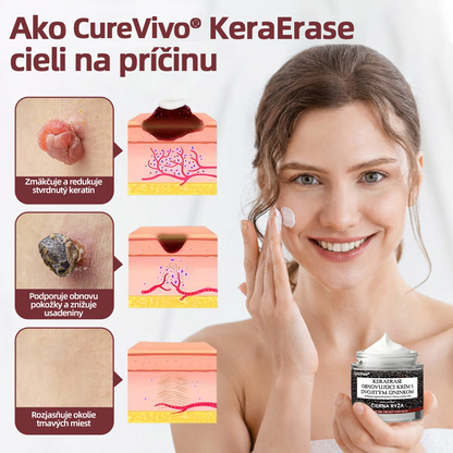 🇸🇰 Dvojčinný obnovovací krém 🧪Curevivo® KeraErase👨‍⚕️