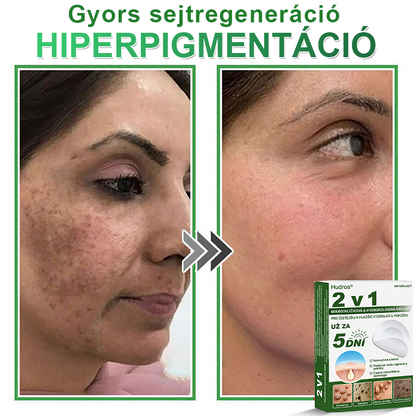 🇸🇰 𝐇𝐮𝐝𝐫𝐨𝐬® 💦💦𝟐-𝐯-𝟏 𝐡𝐲𝐝𝐫𝐨𝐤𝐨𝐥𝐨𝐢𝐝𝐧é 𝐧á𝐩𝐥𝐚𝐬𝐭𝐢 𝐬 𝐦𝐢𝐤𝐫𝐨𝐢𝐡𝐥𝐢č𝐤𝐚𝐦𝐢 | Š𝐩𝐞𝐜𝐢á𝐥𝐧𝐞 𝐯𝐲𝐯𝐢𝐧𝐮𝐭é 𝐧𝐚 𝐨𝐝𝐬𝐭𝐫𝐚ň𝐨𝐯𝐚𝐧𝐢𝐞 𝐯𝐲𝐯ýš𝐞𝐧ý𝐜𝐡 𝐦𝐚𝐭𝐞𝐫𝐬𝐤ý𝐜𝐡 𝐳𝐧𝐚𝐦𝐢𝐞𝐧𝐨𝐤, 𝐚𝐤𝐧é, 𝐩𝐥𝐨𝐜𝐡ý𝐜𝐡 𝐛𝐫𝐚𝐝𝐚𝐯í𝐜 𝐚 𝐤𝐨ž𝐧ý𝐜𝐡 𝐯ý𝐫𝐚𝐬𝐭𝐤𝐨𝐯 | 𝐁𝐚𝐥𝐞𝐧𝐢𝐞 𝟏𝟒𝟒 𝐤𝐮𝐬𝐨𝐯🔬🔬
