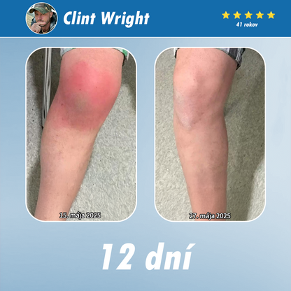 [Novoročná špeciálna ponuka] CureVivo® krém na zmiernenie bolesti a regeneráciu🌱Na bolesti svalov, kĺbov a nervov