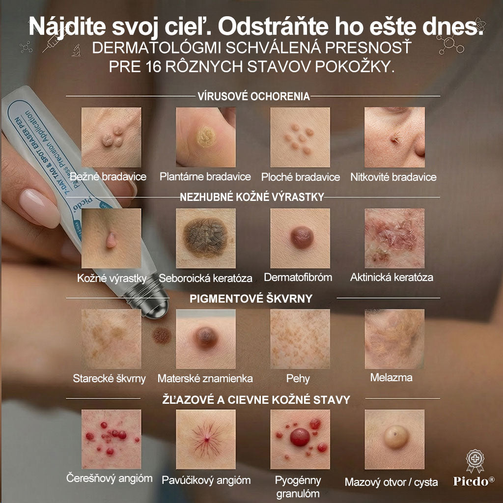 𝐎𝐟𝐢𝐜𝐢𝐚𝐥𝐧𝐲 𝐨𝐛𝐜𝐡𝐨𝐝 𝐦𝐚𝐫𝐤𝐲 | ✅️ 𝐓𝐫𝐢𝐥𝐮𝐦𝐢𝐚® 𝟕𝐝𝐧𝐢 𝐏𝐫í𝐩𝐫𝐚𝐯𝐨𝐤 𝐧𝐚 𝐨𝐝𝐬𝐭𝐫á𝐧𝐞𝐧𝐢𝐞 𝐤𝐨ž𝐧ý𝐜𝐡 𝐯ý𝐫𝐚𝐬𝐭𝐤𝐨𝐯 𝐚 𝐩𝐢𝐠𝐦𝐞𝐧𝐭𝐨𝐯ý𝐜𝐡 š𝐤𝐯ŕ𝐧 (𝐛𝐞𝐳𝐛𝐨𝐥𝐞𝐬𝐭𝐧ý 𝐫𝐨𝐥𝐥-𝐨𝐧 𝐚𝐩𝐥𝐢𝐤á𝐭𝐨𝐫 𝐛𝐞𝐳 𝐣𝐚𝐳𝐢𝐞𝐯) 😍