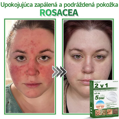 🇸🇰 𝐇𝐮𝐝𝐫𝐨𝐬® 💦💦𝟐-𝐯-𝟏 𝐡𝐲𝐝𝐫𝐨𝐤𝐨𝐥𝐨𝐢𝐝𝐧é 𝐧á𝐩𝐥𝐚𝐬𝐭𝐢 𝐬 𝐦𝐢𝐤𝐫𝐨𝐢𝐡𝐥𝐢č𝐤𝐚𝐦𝐢 | Š𝐩𝐞𝐜𝐢á𝐥𝐧𝐞 𝐯𝐲𝐯𝐢𝐧𝐮𝐭é 𝐧𝐚 𝐨𝐝𝐬𝐭𝐫𝐚ň𝐨𝐯𝐚𝐧𝐢𝐞 𝐯𝐲𝐯ýš𝐞𝐧ý𝐜𝐡 𝐦𝐚𝐭𝐞𝐫𝐬𝐤ý𝐜𝐡 𝐳𝐧𝐚𝐦𝐢𝐞𝐧𝐨𝐤, 𝐚𝐤𝐧é, 𝐩𝐥𝐨𝐜𝐡ý𝐜𝐡 𝐛𝐫𝐚𝐝𝐚𝐯í𝐜 𝐚 𝐤𝐨ž𝐧ý𝐜𝐡 𝐯ý𝐫𝐚𝐬𝐭𝐤𝐨𝐯 | 𝐁𝐚𝐥𝐞𝐧𝐢𝐞 𝟏𝟒𝟒 𝐤𝐮𝐬𝐨𝐯🔬🔬