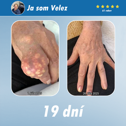 [Novoročná špeciálna ponuka] CureVivo® krém na zmiernenie bolesti a regeneráciu🌱Na bolesti svalov, kĺbov a nervov