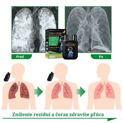 💝✅Oficiálny obchod::Thonesr® Bylinný Inhalátor Na Čistenie Pľúc🫁Schválené ŠÚKL(💝 Cough, wheezing, shortness of breath, sputum, stuffy nose, bronchitis, bronchitis, allergy symptoms, lung discomfort💝)