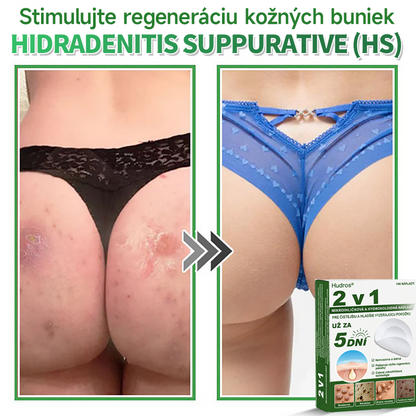 🇸🇰 𝐇𝐮𝐝𝐫𝐨𝐬® 💦💦𝟐-𝐯-𝟏 𝐡𝐲𝐝𝐫𝐨𝐤𝐨𝐥𝐨𝐢𝐝𝐧é 𝐧á𝐩𝐥𝐚𝐬𝐭𝐢 𝐬 𝐦𝐢𝐤𝐫𝐨𝐢𝐡𝐥𝐢č𝐤𝐚𝐦𝐢 | Š𝐩𝐞𝐜𝐢á𝐥𝐧𝐞 𝐯𝐲𝐯𝐢𝐧𝐮𝐭é 𝐧𝐚 𝐨𝐝𝐬𝐭𝐫𝐚ň𝐨𝐯𝐚𝐧𝐢𝐞 𝐯𝐲𝐯ýš𝐞𝐧ý𝐜𝐡 𝐦𝐚𝐭𝐞𝐫𝐬𝐤ý𝐜𝐡 𝐳𝐧𝐚𝐦𝐢𝐞𝐧𝐨𝐤, 𝐚𝐤𝐧é, 𝐩𝐥𝐨𝐜𝐡ý𝐜𝐡 𝐛𝐫𝐚𝐝𝐚𝐯í𝐜 𝐚 𝐤𝐨ž𝐧ý𝐜𝐡 𝐯ý𝐫𝐚𝐬𝐭𝐤𝐨𝐯 | 𝐁𝐚𝐥𝐞𝐧𝐢𝐞 𝟏𝟒𝟒 𝐤𝐮𝐬𝐨𝐯🔬🔬